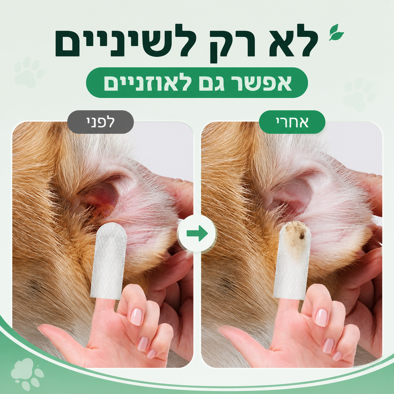 מגבונים דנטליים לניקוי השיניים