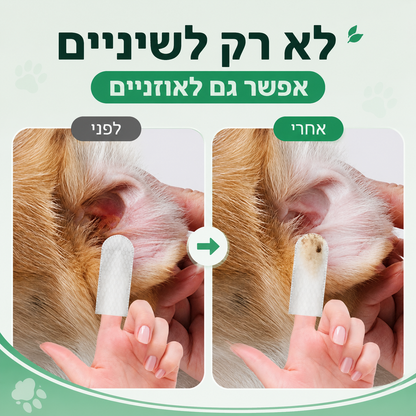 מגבונים דנטליים לניקוי השיניים